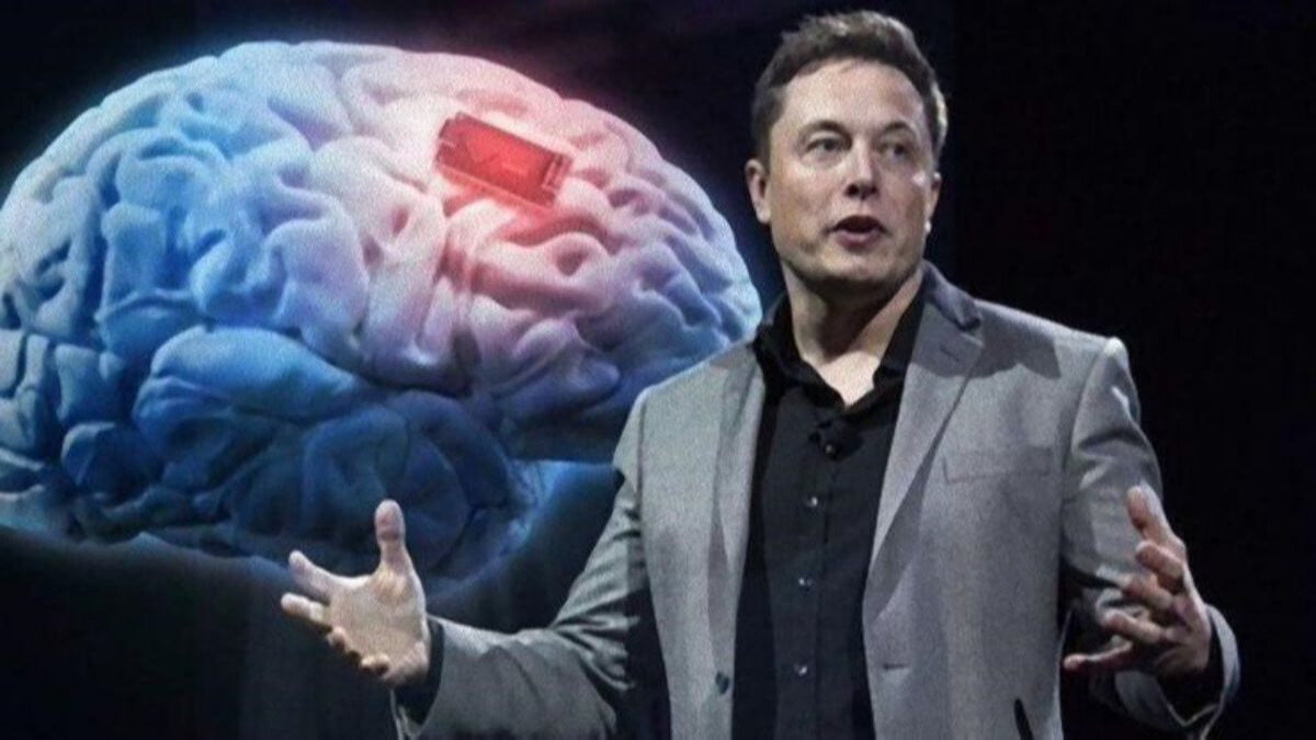 Elon Muskin Beyin Cipi Sirketi Neuralinkin Degeri 5 Milyar Dolara Ul F0301835